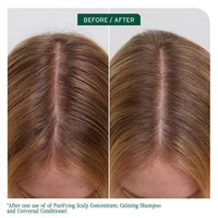 Biolage Scalp Sync Clarifying Shampoo 400ml