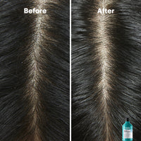L'Oréal Serie Expert Scalp Advanced Anti-Dandruff Dermo Clarifier Shampoo 300ml