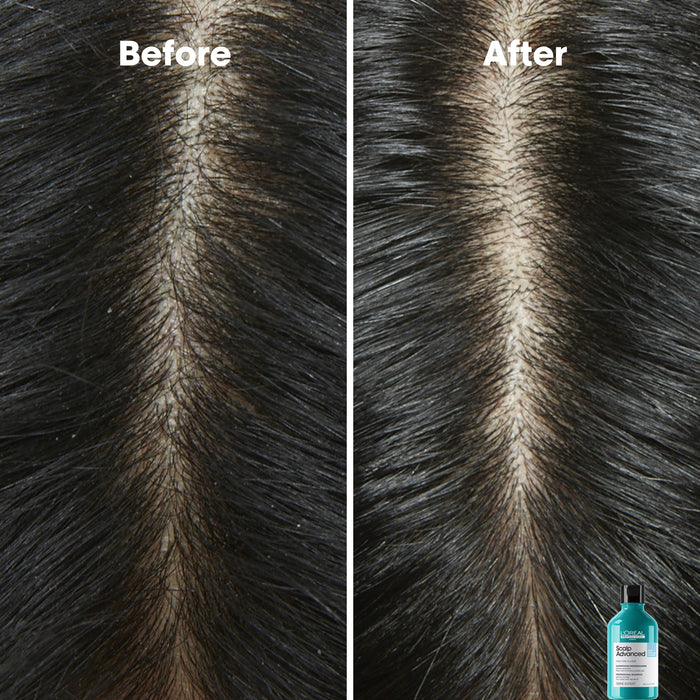 L'Oréal Serie Expert Scalp Advanced Anti-Dandruff Dermo Clarifier Shampoo 300ml