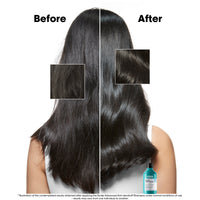 L'Oréal Serie Expert Scalp Advanced Anti-Dandruff Dermo Clarifier Shampoo 300ml