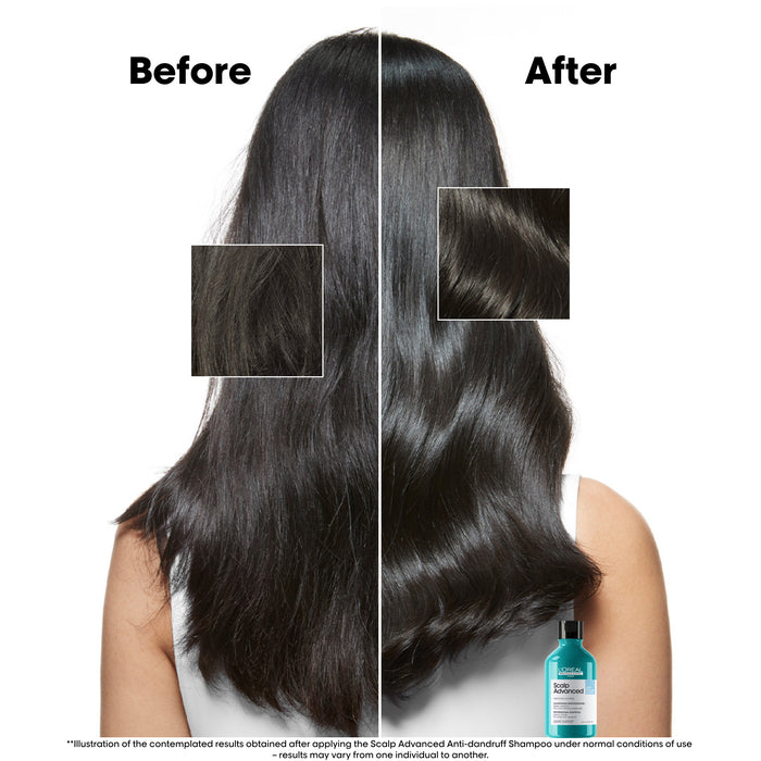 L'Oréal Serie Expert Scalp Advanced Anti-Dandruff Dermo Clarifier Shampoo 300ml