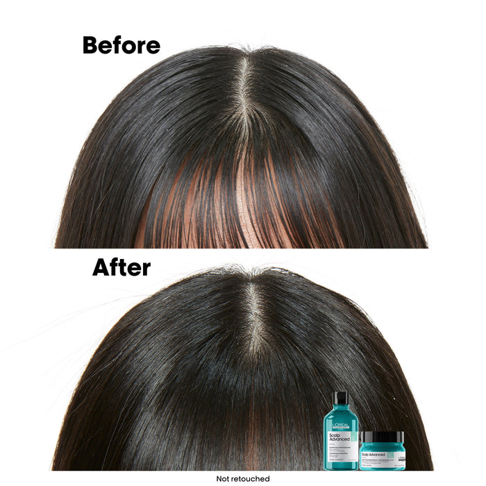 L'Oréal Serie Expert Scalp Advanced Anti-Oilness 2in1 Deep Purifier Mask 250ml