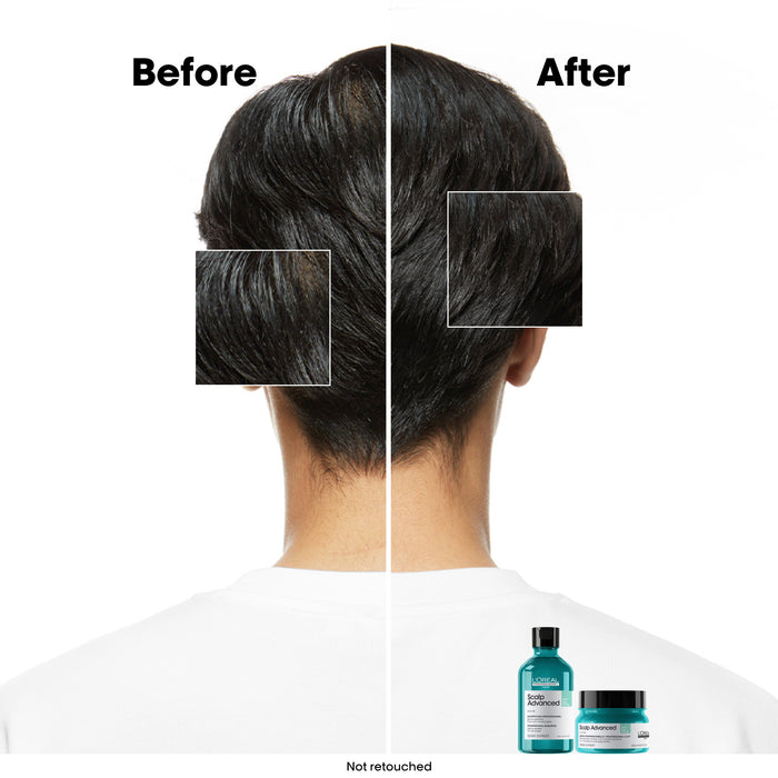 L'Oréal Serie Expert Scalp Advanced Anti-Oilness 2in1 Deep Purifier Mask 250ml