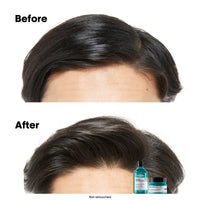 L'Oréal Serie Expert Scalp Advanced Anti-Oilness 2in1 Deep Purifier Mask 250ml