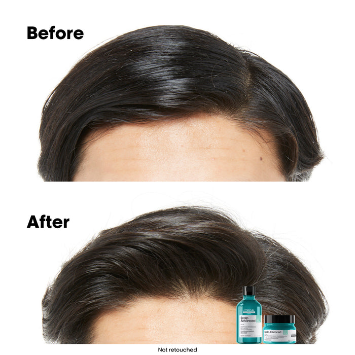 L'Oréal Serie Expert Scalp Advanced Anti-Oilness 2in1 Deep Purifier Mask 250ml