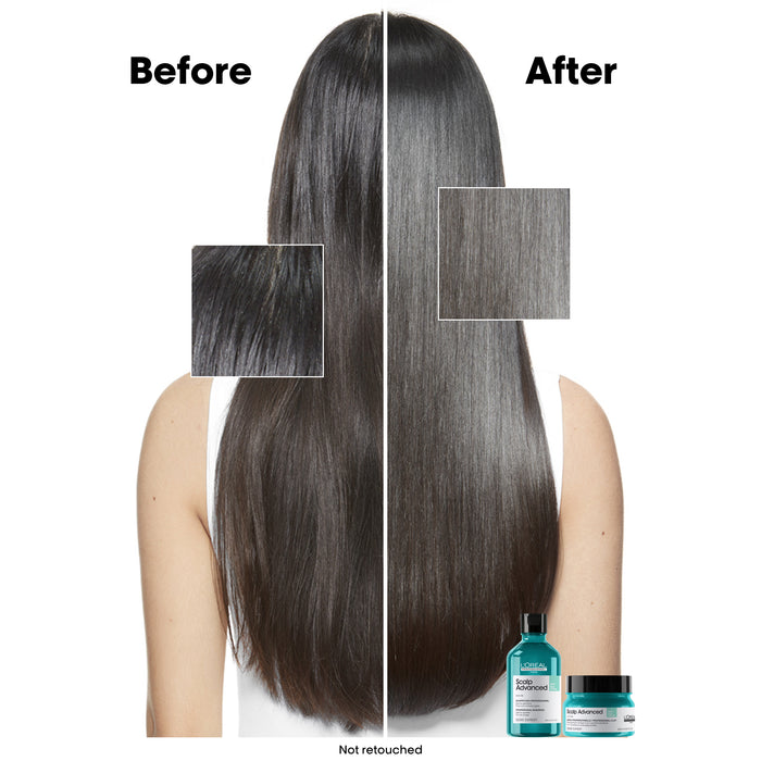 L'Oréal Serie Expert Scalp Advanced Anti-Oilness 2in1 Deep Purifier Mask 250ml