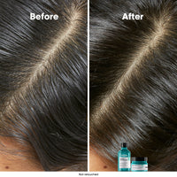 L'Oréal Serie Expert Scalp Advanced Anti-Oilness Dermo Purifier Shampoo 300ml