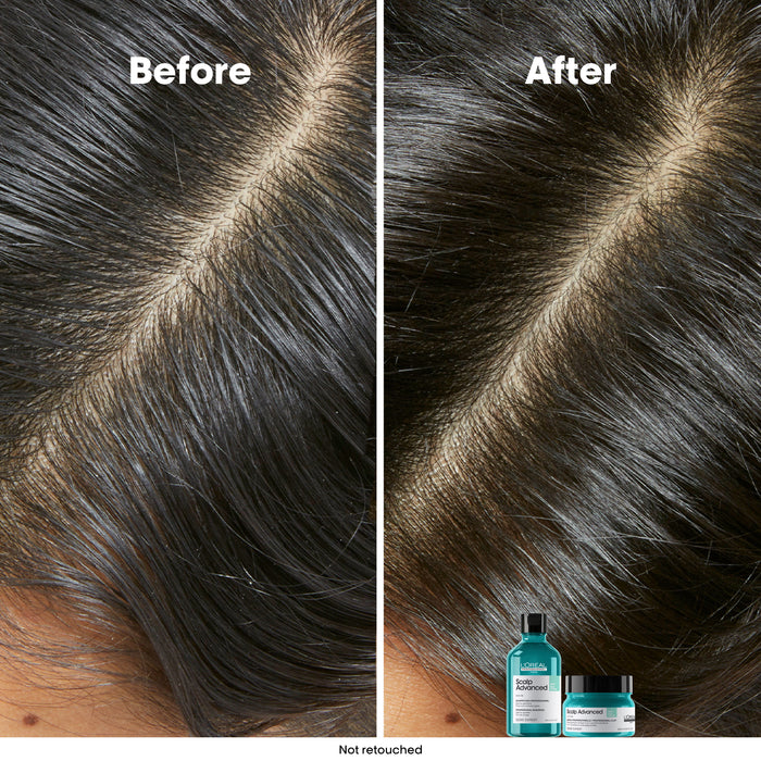 L'Oréal Serie Expert Scalp Advanced Anti-Oilness Dermo Purifier Shampoo 300ml