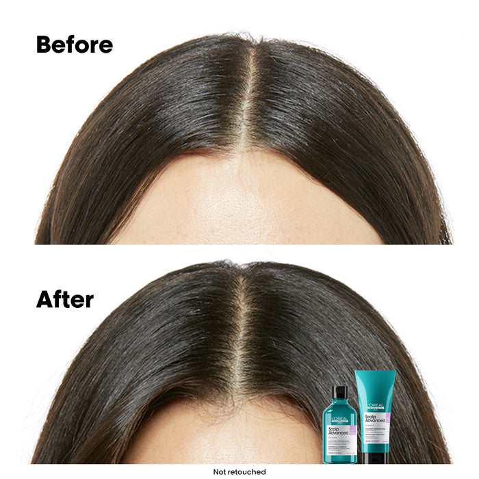L'Oréal Serie Expert Scalp Advanced Anti-Discomfort Shampoo 1500ml