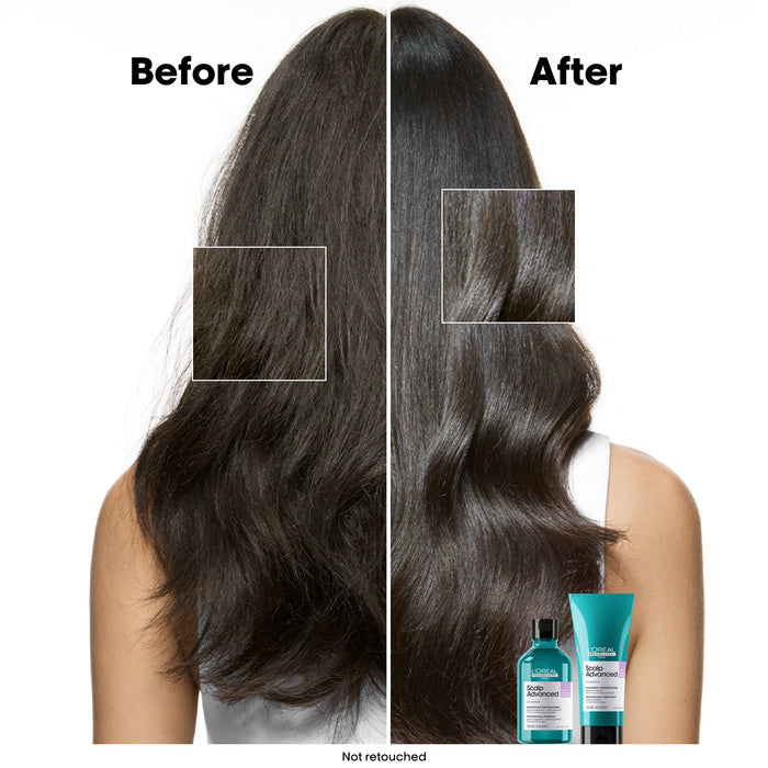 L'Oréal Serie Expert Scalp Advanced Anti-Discomfort Shampoo 1500ml
